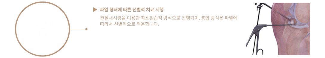 이미지명